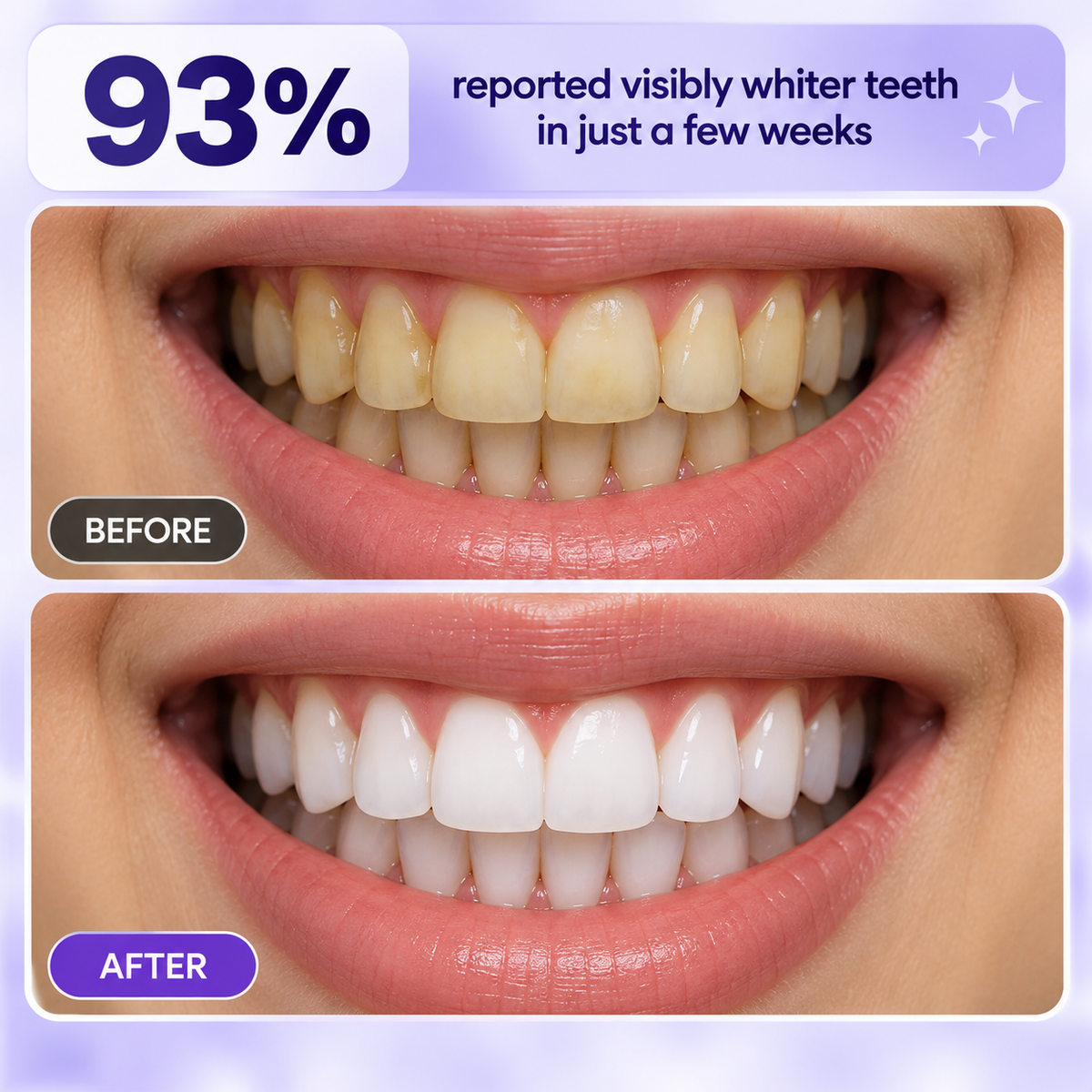 Purple Teeth Brightening Tablets