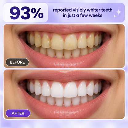 Purple Teeth Brightening Tablets